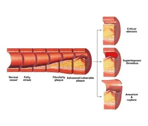 A concise diagram illustrating the internal structure of the heart, featuring chambers, valves, and key blood vessels.