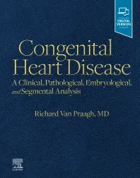 Congenital Heart Disease